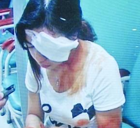 火锅店服务员添酒精时炸锅 多人烧伤