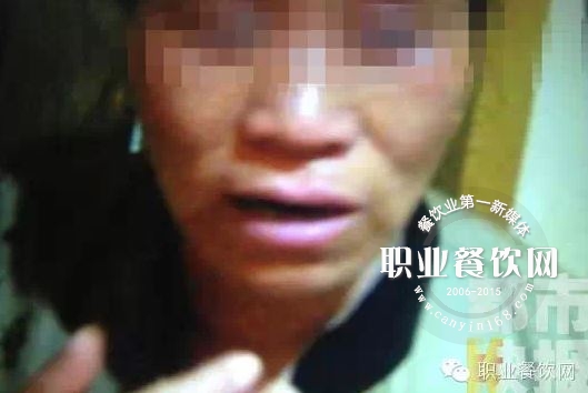 火锅店服务员在收台，火锅突然爆炸多名服务员被烫伤