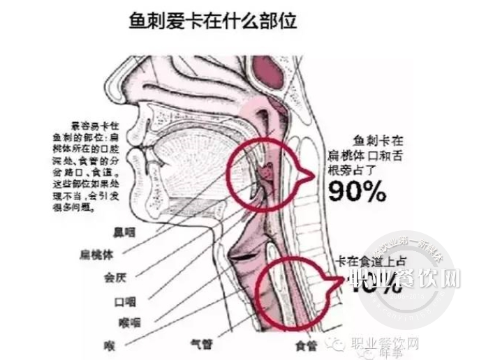 鱼刺卡喉，平淡中透着恐怖！