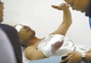 两女子没钱付账，留下纸盒炸断右臂