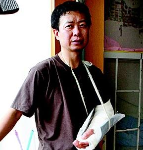 厨师被同事打骨折